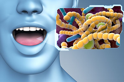 The image shows a 3D rendering of a human face with an open mouth, next to a microscopic depiction of yellow bacteria or germs.