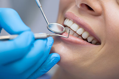 The image shows a person receiving dental care with a smiling expression, wearing a blue surgical mask and having their teeth cleaned by a dental professional using a dental pick.