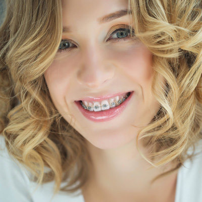 A woman with straight teeth and braces, smiling at the camera.