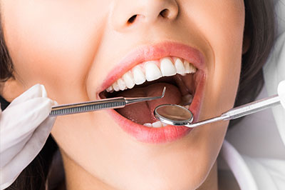 A woman with a wide smile, sitting in a dental chair while receiving dental treatment, with a focus on her open mouth and teeth cleaning instruments.