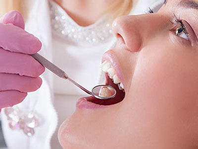 A dental hygienist using a dental tool to clean a person s teeth in a dental office setting.